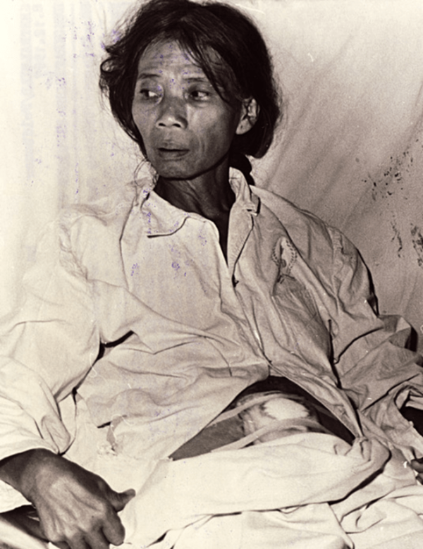 Krankenhäuser im Fadenkreuz – Während des Luftkrieges gegen die DRV wurden 250 Krankenhäuser, 1 500 Pflege- und Entbindungsstationen völlig zerstört