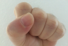 Unter den Juden von Rom „etwa hundert Schlägertypen“?