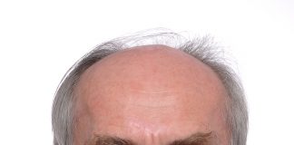 Grausamkeiten haben eine gemeinsame Wurzel! – Prof. Dr. Franz Mühlbauer zu höheren Fleischpreisen und Tierwohllabels