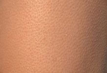 Kommentar: „Gänsehautmoment“ einer Christin mit einem Faschisten – Julia Glöckner (CDU) von Ruslan Stefantschuk aus Banderastan ausgezeichnet