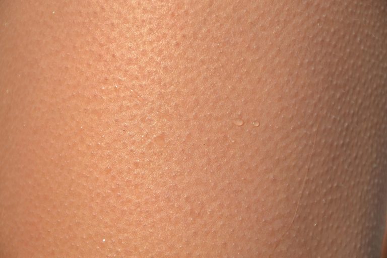 Kommentar: „Gänsehautmoment“ einer Christin mit einem Faschisten – Julia Glöckner (CDU) von Ruslan Stefantschuk aus Banderastan ausgezeichnet